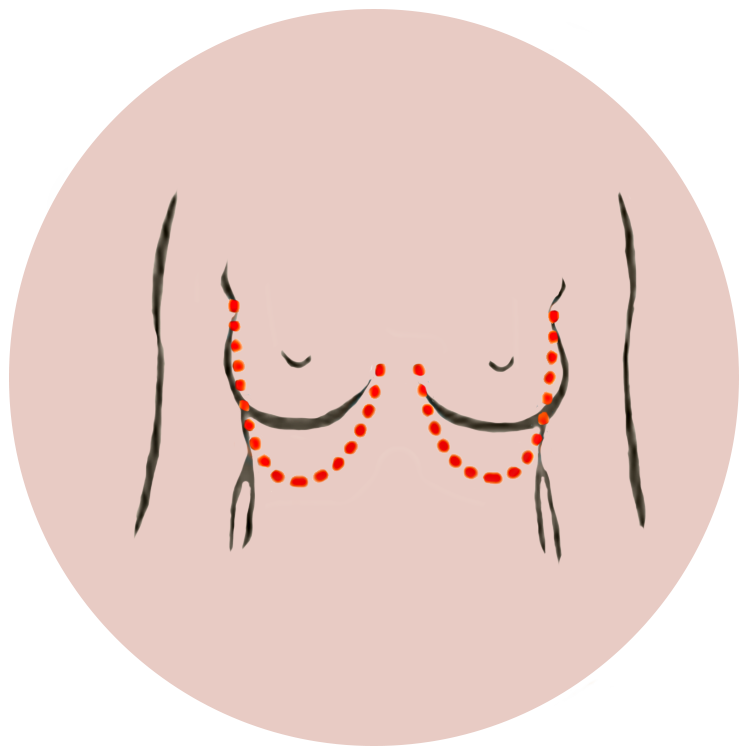 borstllift-illustratie-rond.png