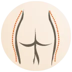 liposculptuur-illustratie.webp