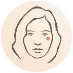 moedervlek-laseren-illustratie-rond.webp