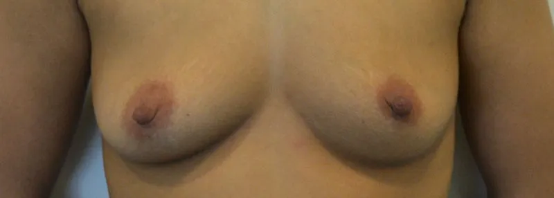 Voor