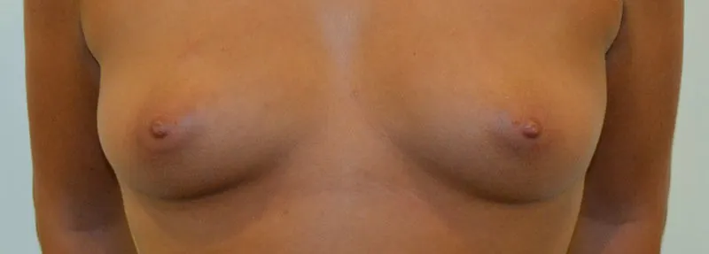Voor