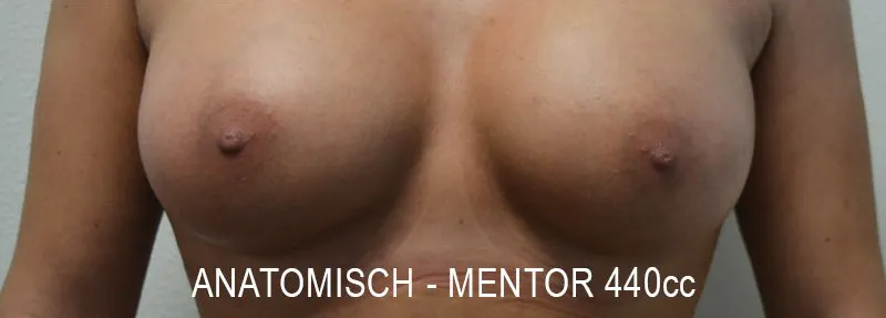 Na