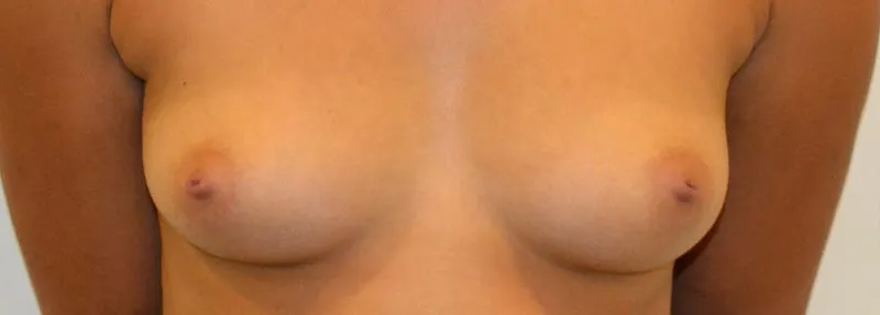 Voor