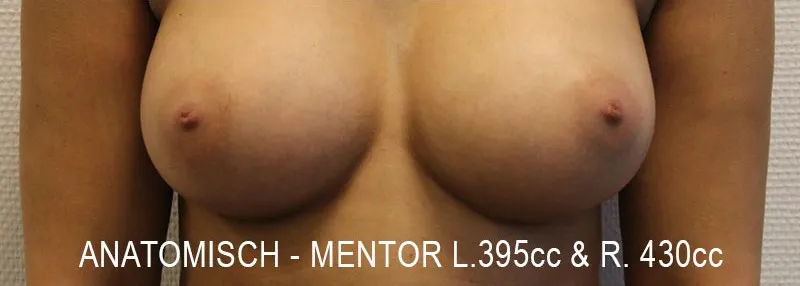 Na