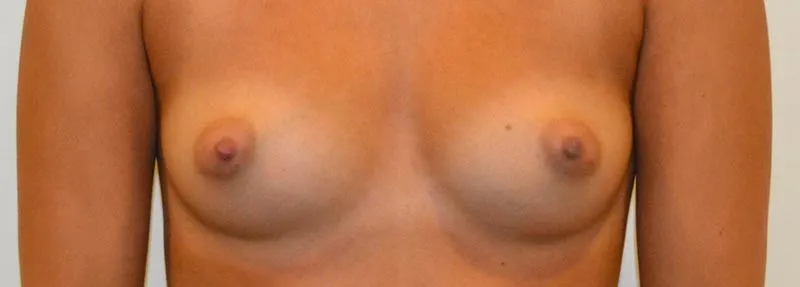 Voor