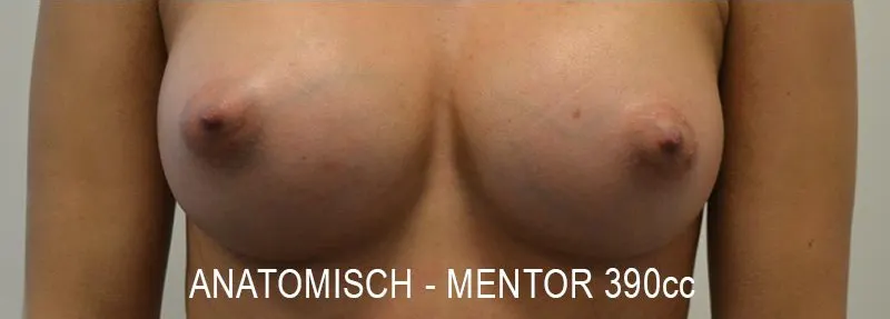 Na