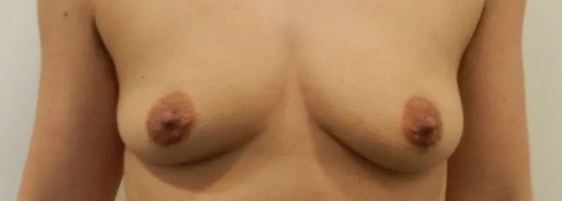 Voor