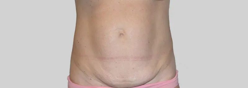 Voor