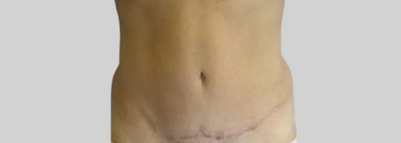 Na