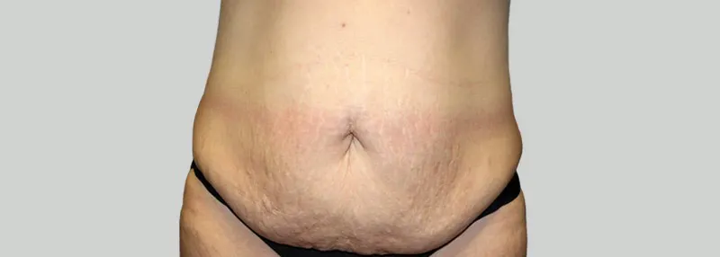 Voor
