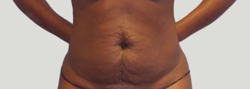 Voor