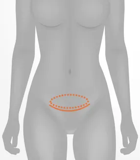 bwc-2-illustratie-web-v1-1-2447.webp