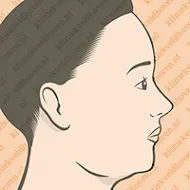 facelift-macs-v3_001.webp