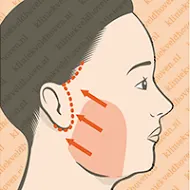 facelift-macs-v3_002.webp