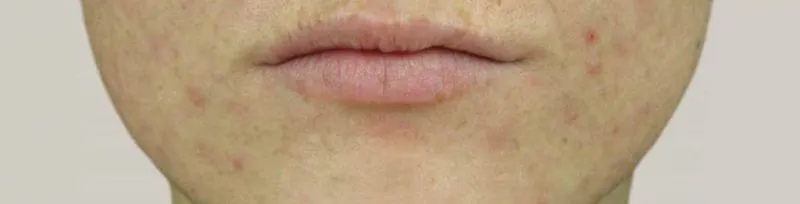 Na