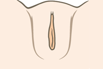 labiacorrectie-na.png