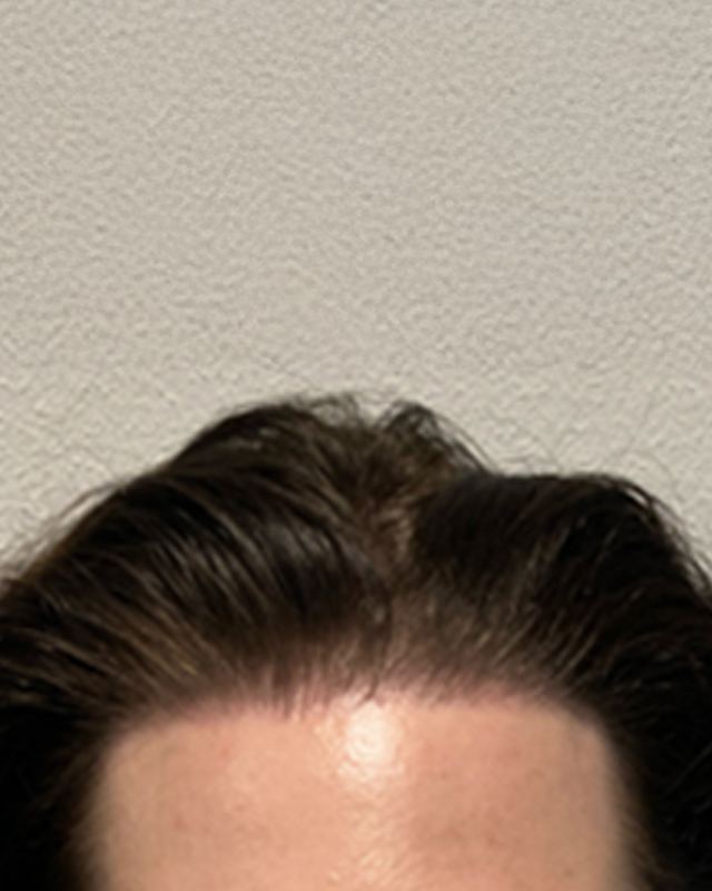 Na