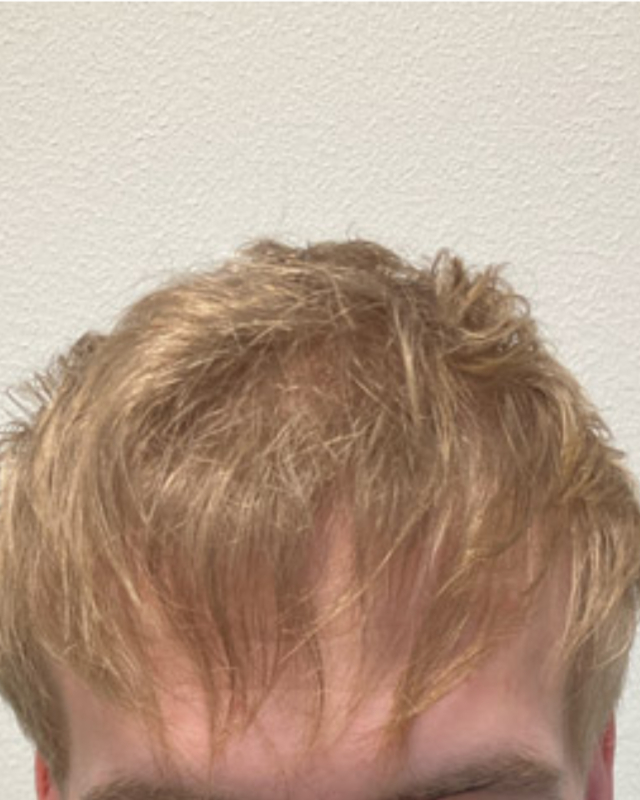Na
