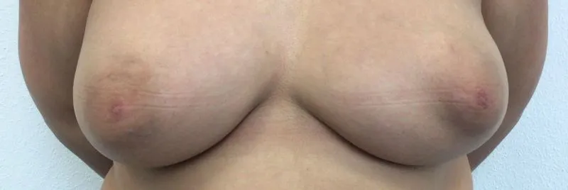 Na