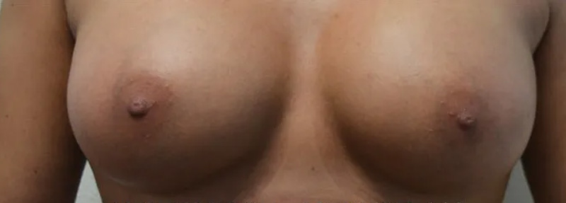 Na