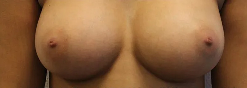 Na