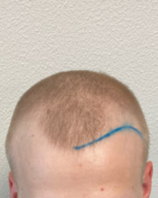 Voor