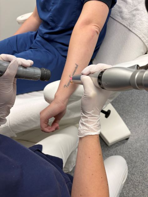 Tatoeageverwijdering: onze werkwijze en expertise 