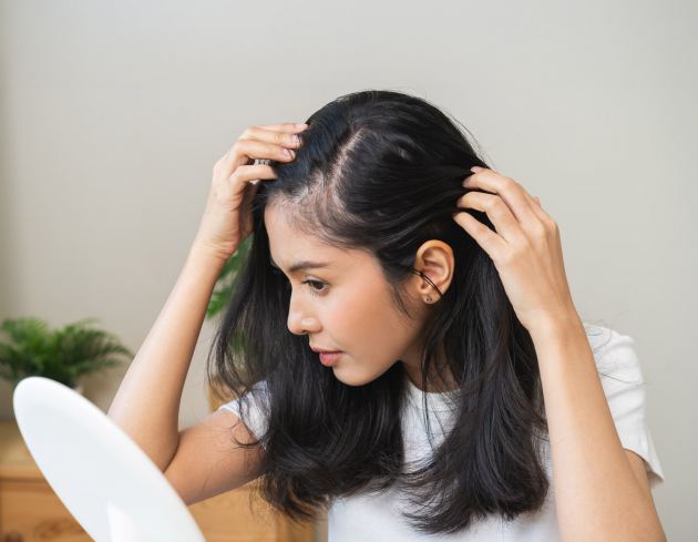 Ook vrouwen hebben baat bij een haartransplantatie