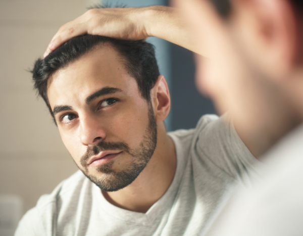 5 factoren voor een geslaagde haartransplantatie