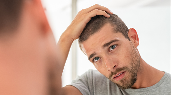 Vergeten vragen tijdens een haartransplantatie consult