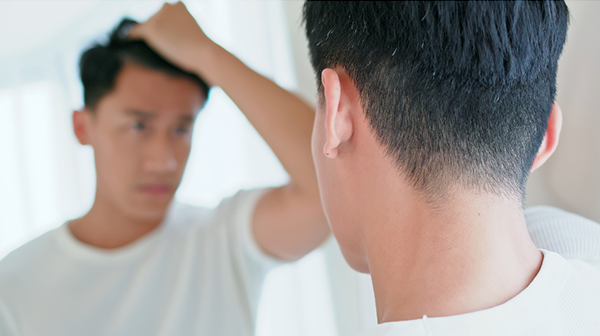 Haartransplantatie is een boost voor het zelfvertrouwen