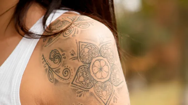 Tatoeage weghalen is in!